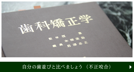 自分の歯並びと比べましょう（不正咬合）